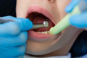 hygotipxlbio-klinisk-liggande-4